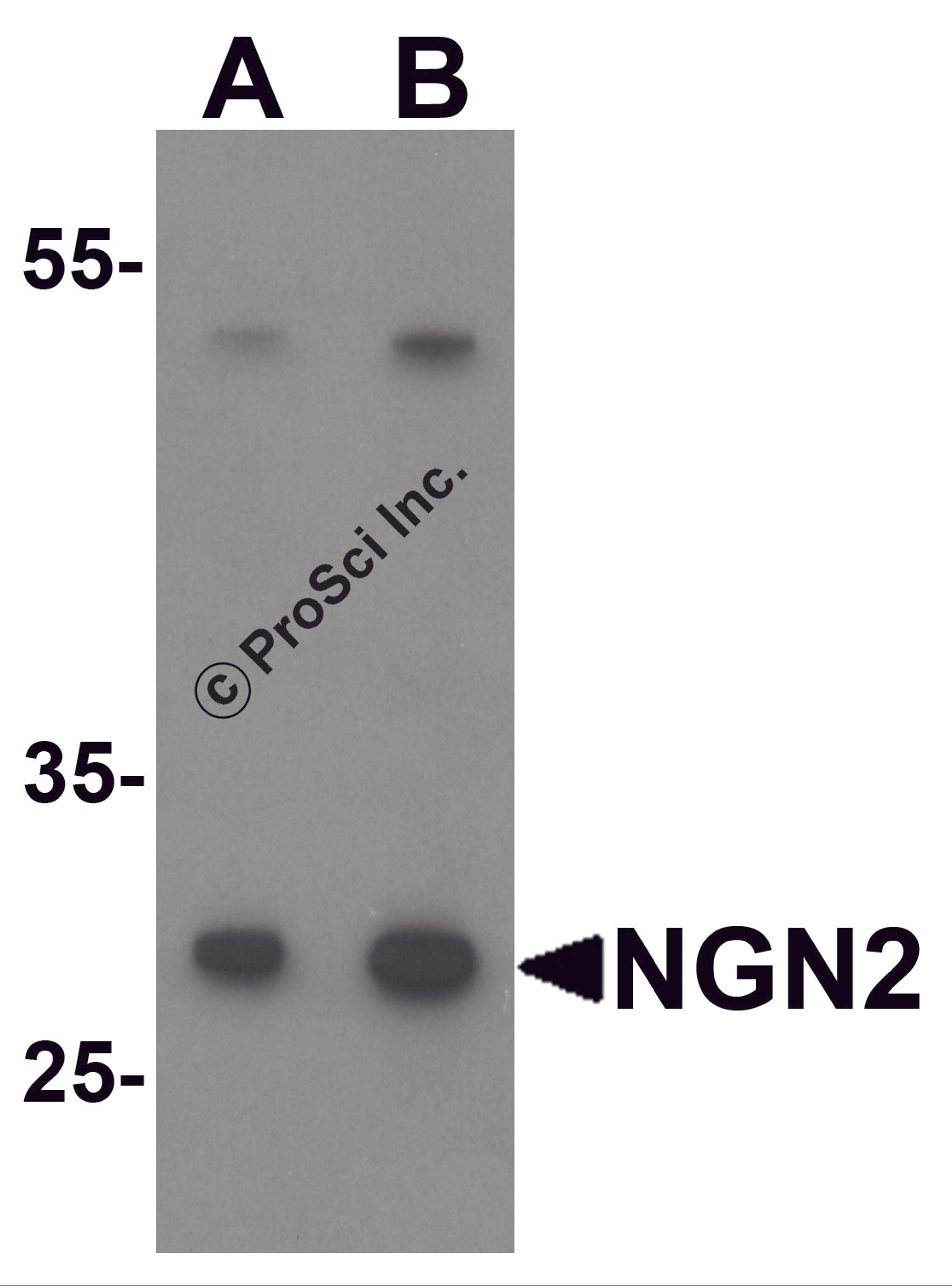 Western blot analysis of NGN2 in mouse small intestine tissue lysate with NGN2 antibody at (A) 1 and (B) 2 &#956;g/mL.