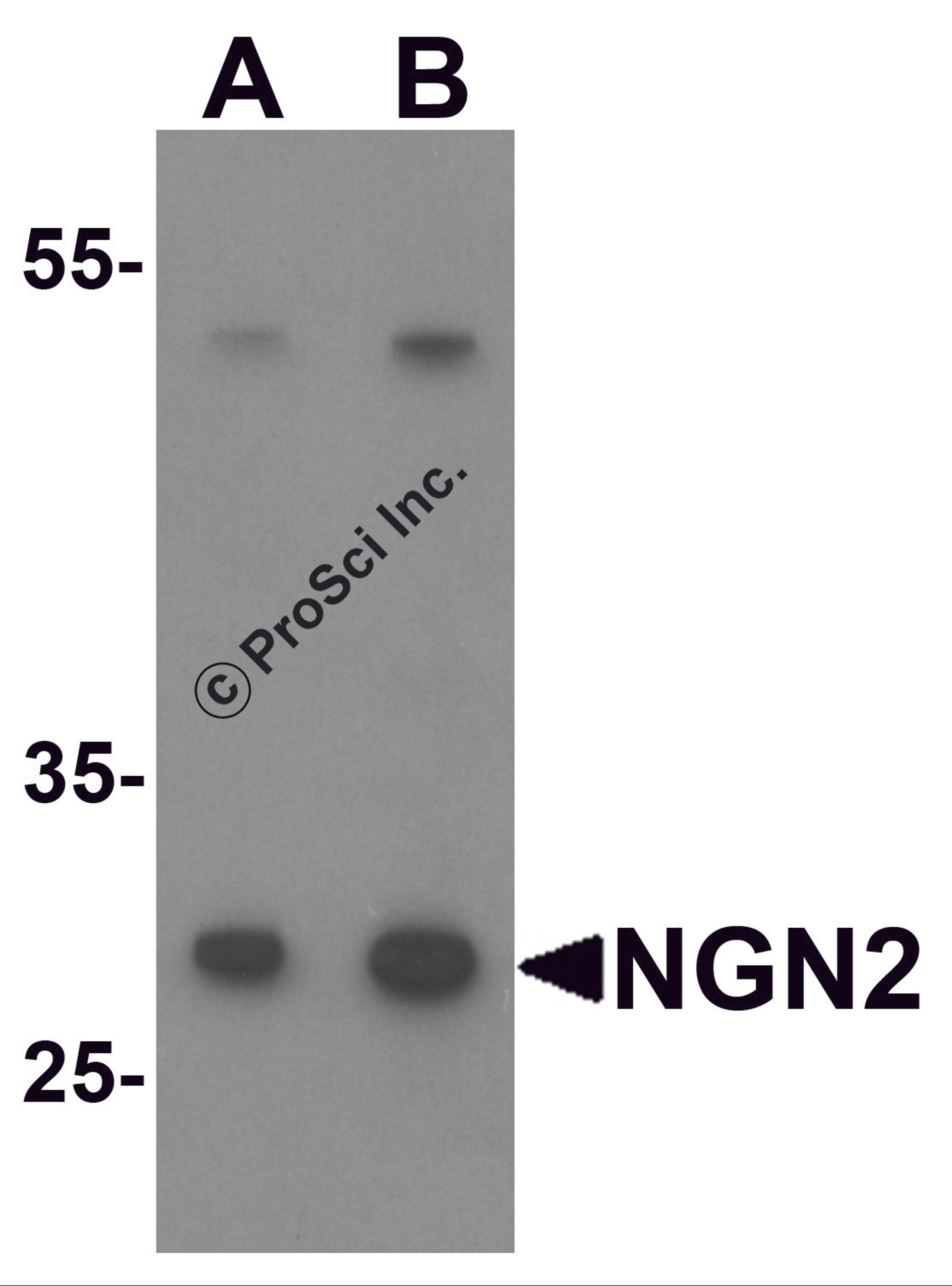 Western blot analysis of NGN2 in mouse small intestine tissue lysate with NGN2 antibody at (A) 1 and (B) 2 μg/mL.