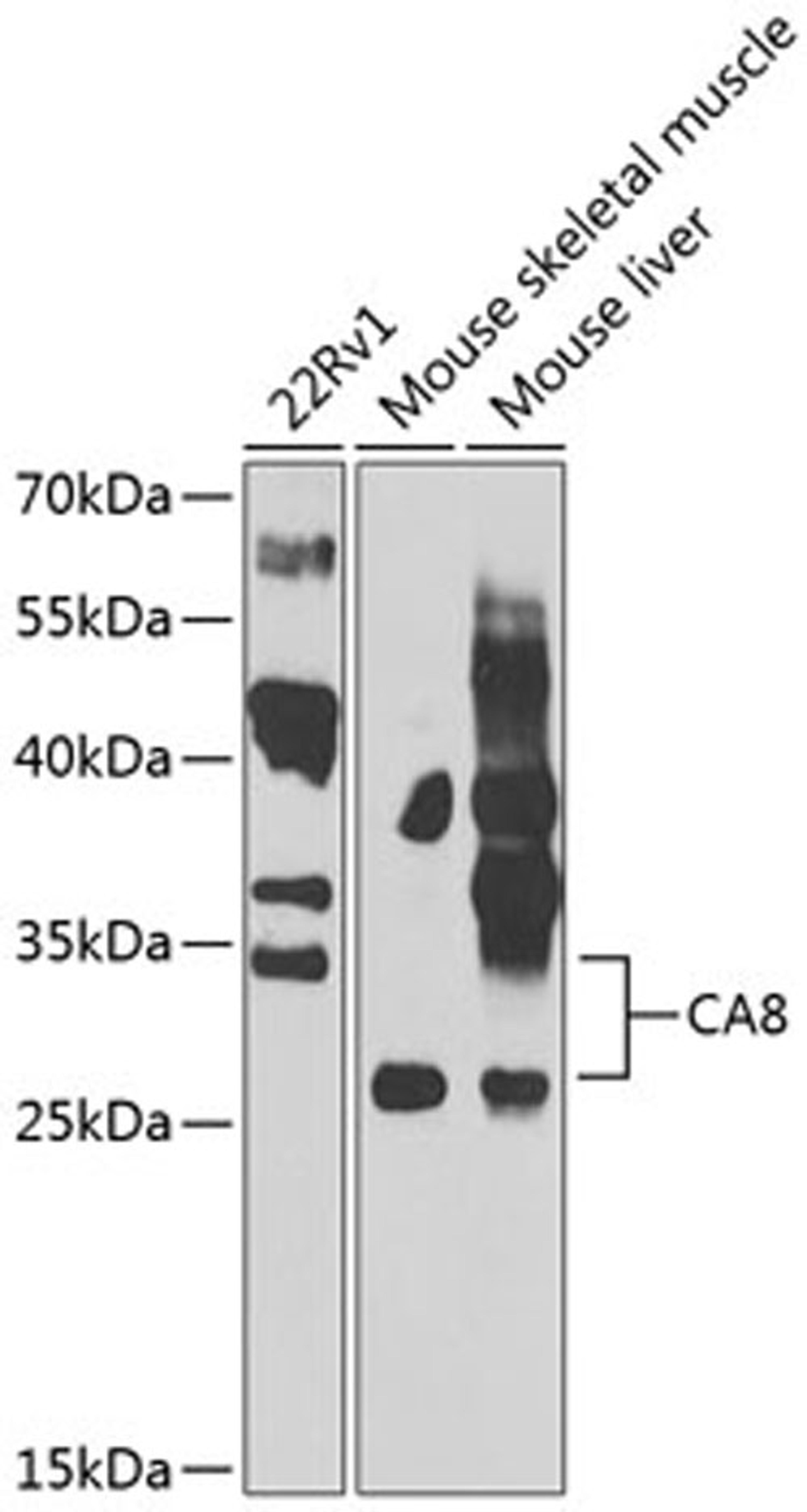 Western blot - CA8 antibody (A7544)