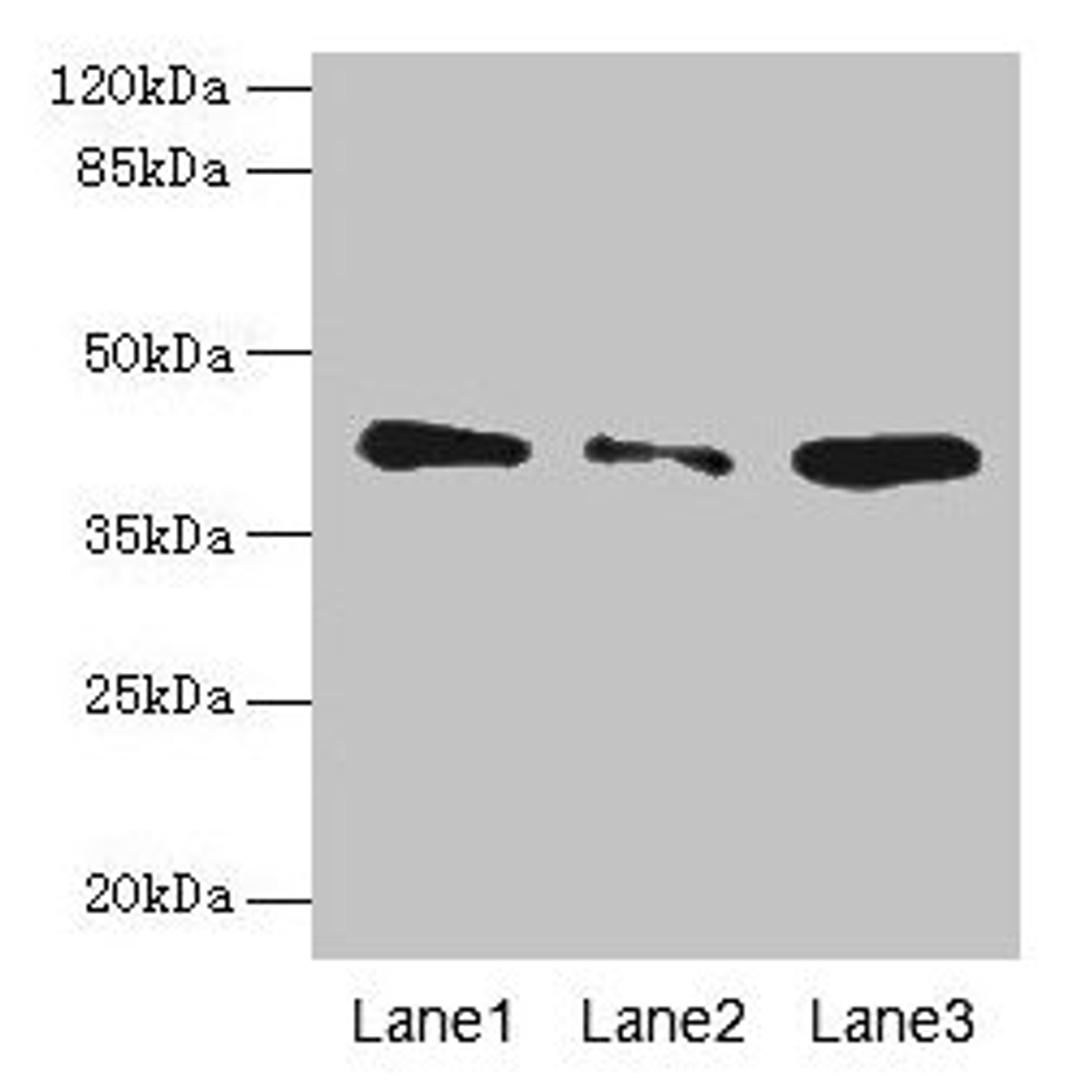 Western blot. All lanes: SGCA antibody at 0.5µg/ml. Lane 1: Jurkat whole cell lysate. Lane 2: HepG2 whole cell lysate. Lane 3: 293T whole cell lysate. Secondary. Goat polyclonal to rabbit IgG at 1/10000 dilution. Predicted band size: 43, 30 kDa. Observed band size: 43 kDa