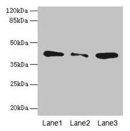 Western blot. All lanes: SGCA antibody at 0.5µg/ml. Lane 1: Jurkat whole cell lysate. Lane 2: HepG2 whole cell lysate. Lane 3: 293T whole cell lysate. Secondary. Goat polyclonal to rabbit IgG at 1/10000 dilution. Predicted band size: 43, 30 kDa. Observed band size: 43 kDa