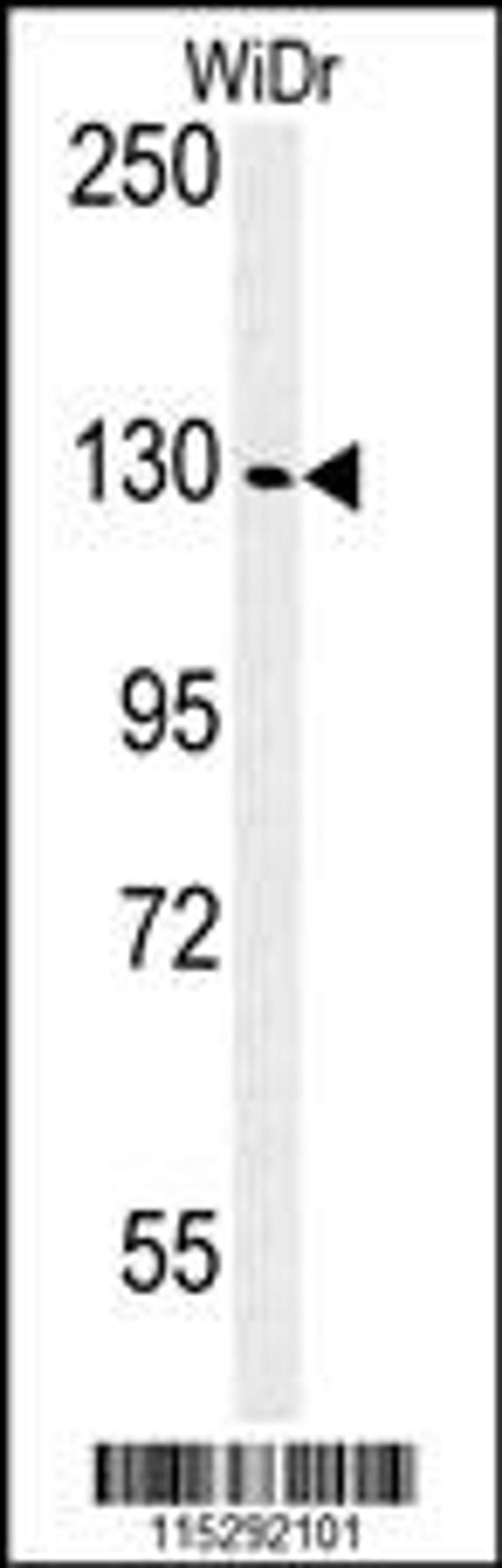 Western blot analysis of IGF1R Antibody (N-term K66) in WiDr cell line lysates (35ug/lane)