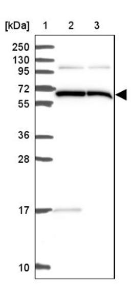 Western Blot: ALG8 Antibody [NBP2-47550] - Lane 1: Marker [kDa] 250, 130, 95, 72, 55, 36, 28, 17, 10.  Lane 2: Human cell line RT-4.  Lane 3: Human cell line U-251MG.