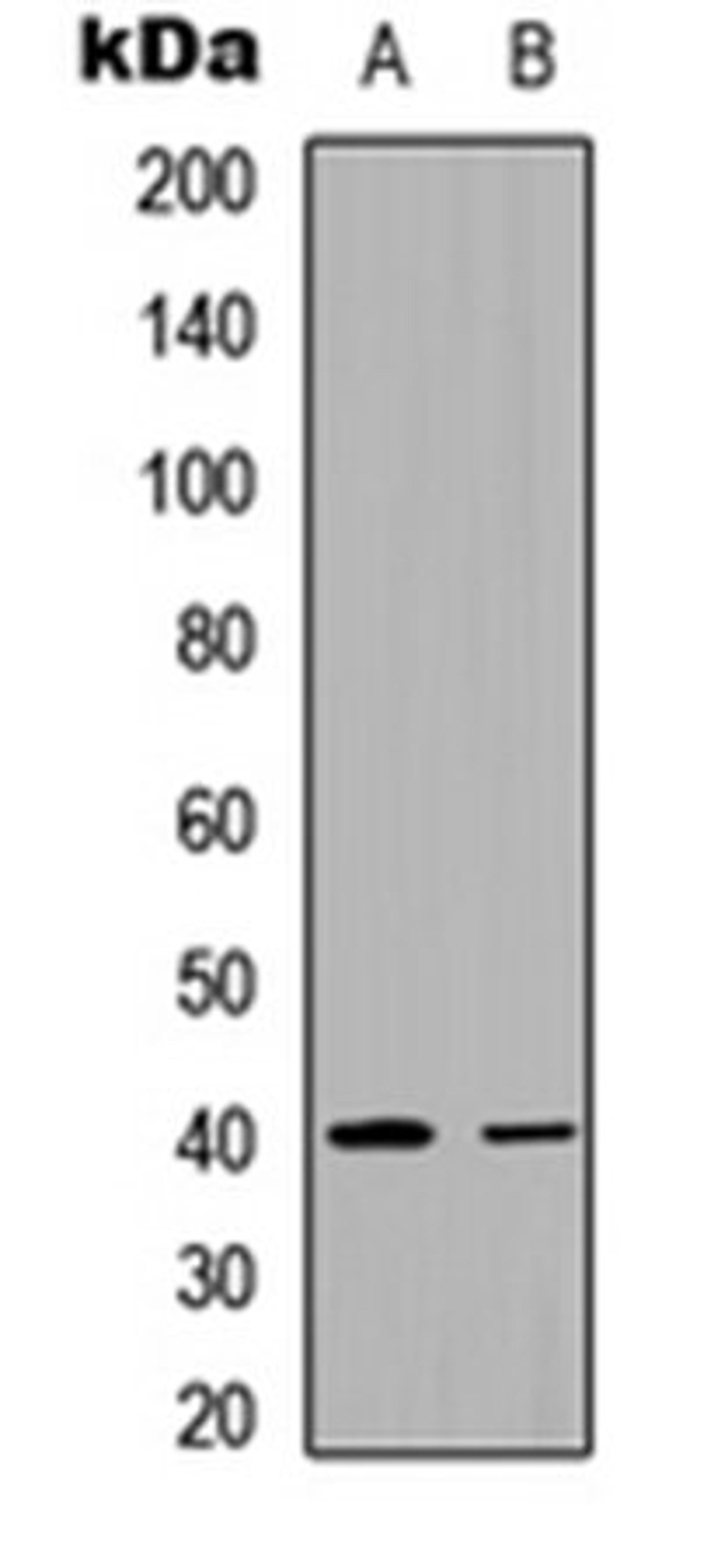 Western blot analysis of HeLa (Lane 1), rat muscle (Lane 2) whole cell lysates using FX antibody