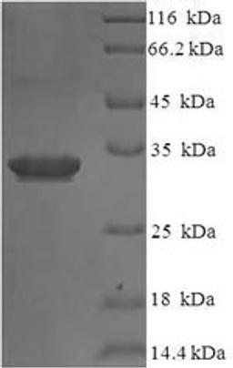 (Tris-Glycine gel) Discontinuous SDS-PAGE (reduced) with 5% enrichment gel and 15% separation gel.