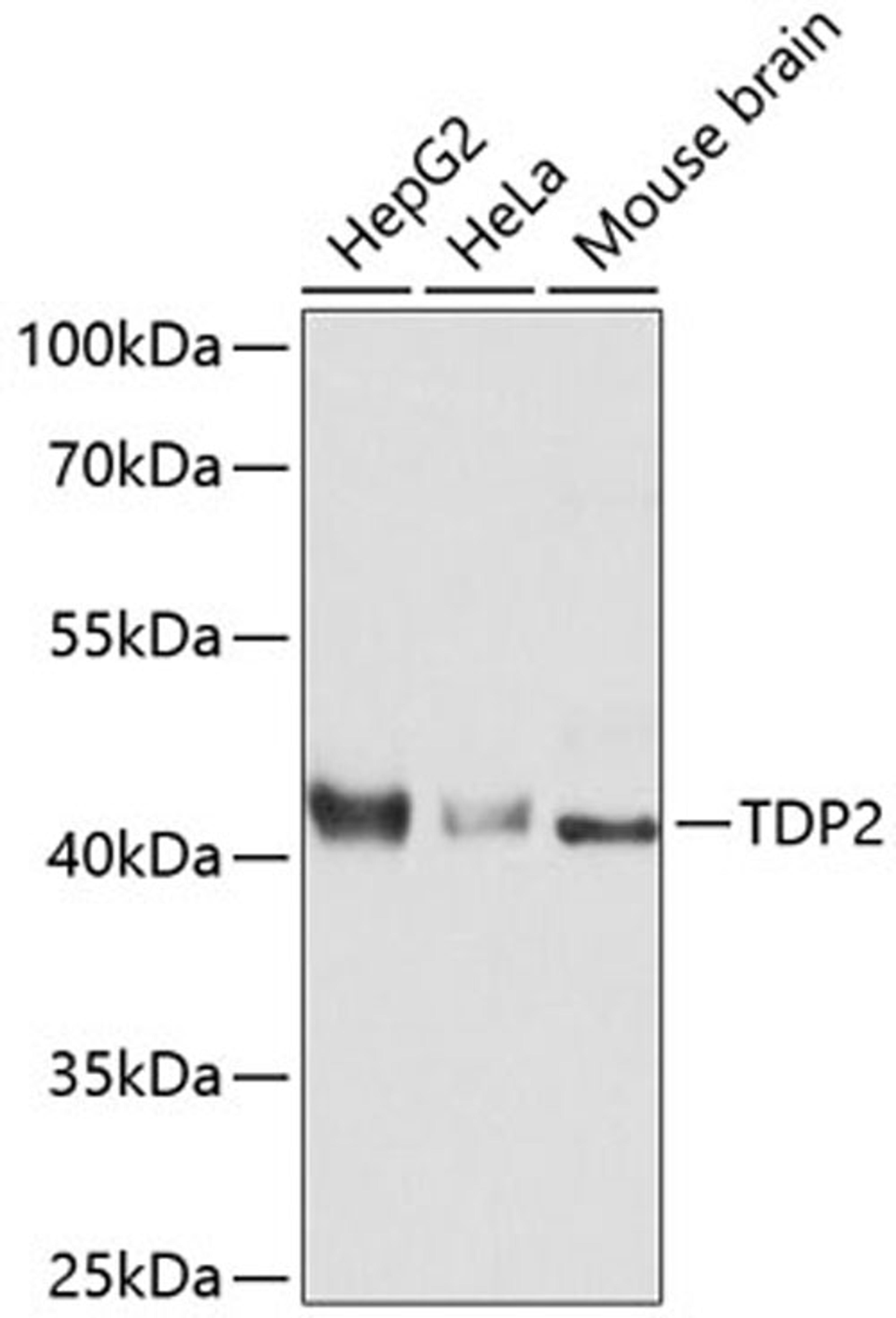 Western blot - TDP2 Antibody (A11617)