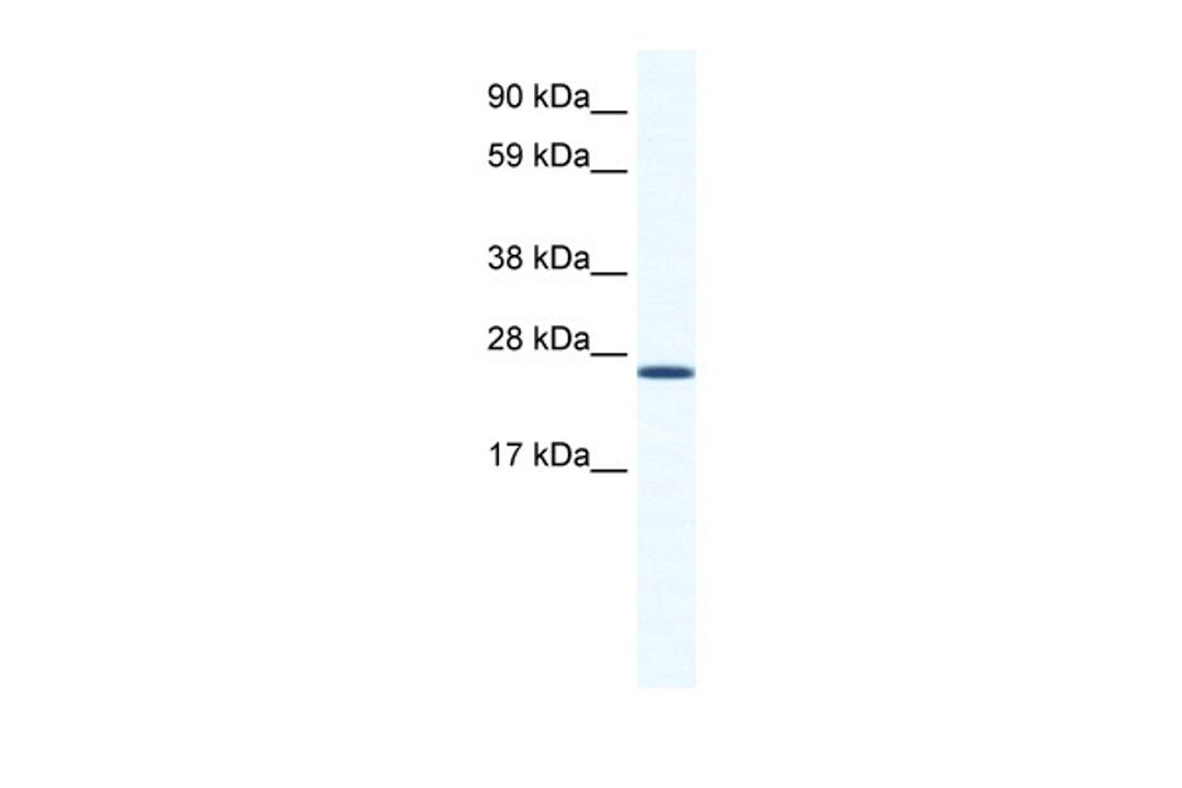 Antibody used in WB on Mouse NIH-3T3 at 1.25 ug/ml.