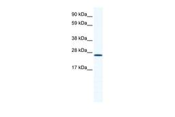 Antibody used in WB on Mouse NIH-3T3 at 1.25 ug/ml.