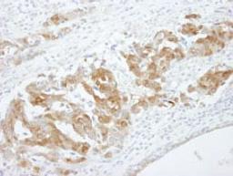 Detection of human CRABP2 by immunohistochemistry.