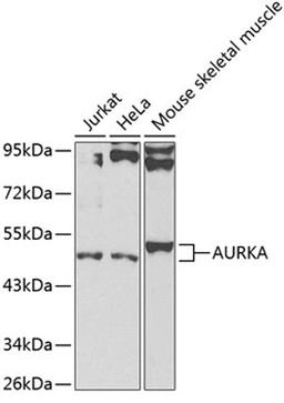 Western blot - AURKA antibody (A2121)