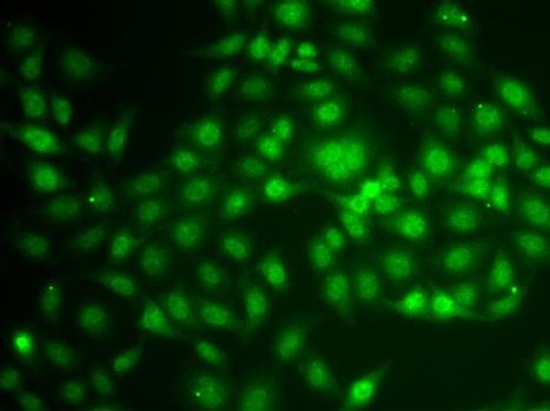 Immunofluorescense analysis of A549 cell using LDLRAP1 antibody