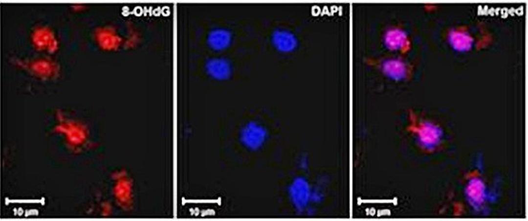 Confocal immunofluorescense analysis of ischemic rat brain tissue using DNA/RNA Damage antibody