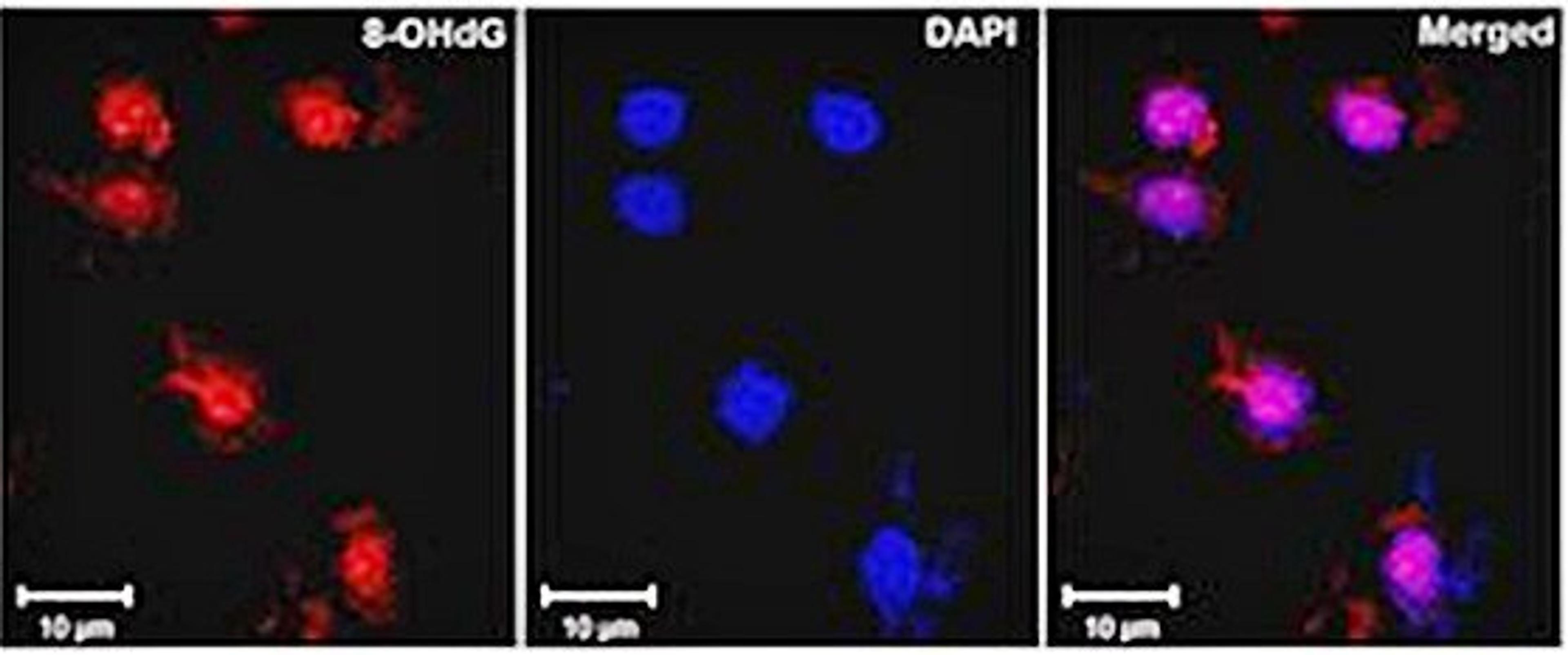 Confocal immunofluorescense analysis of ischemic rat brain tissue using DNA/RNA Damage antibody