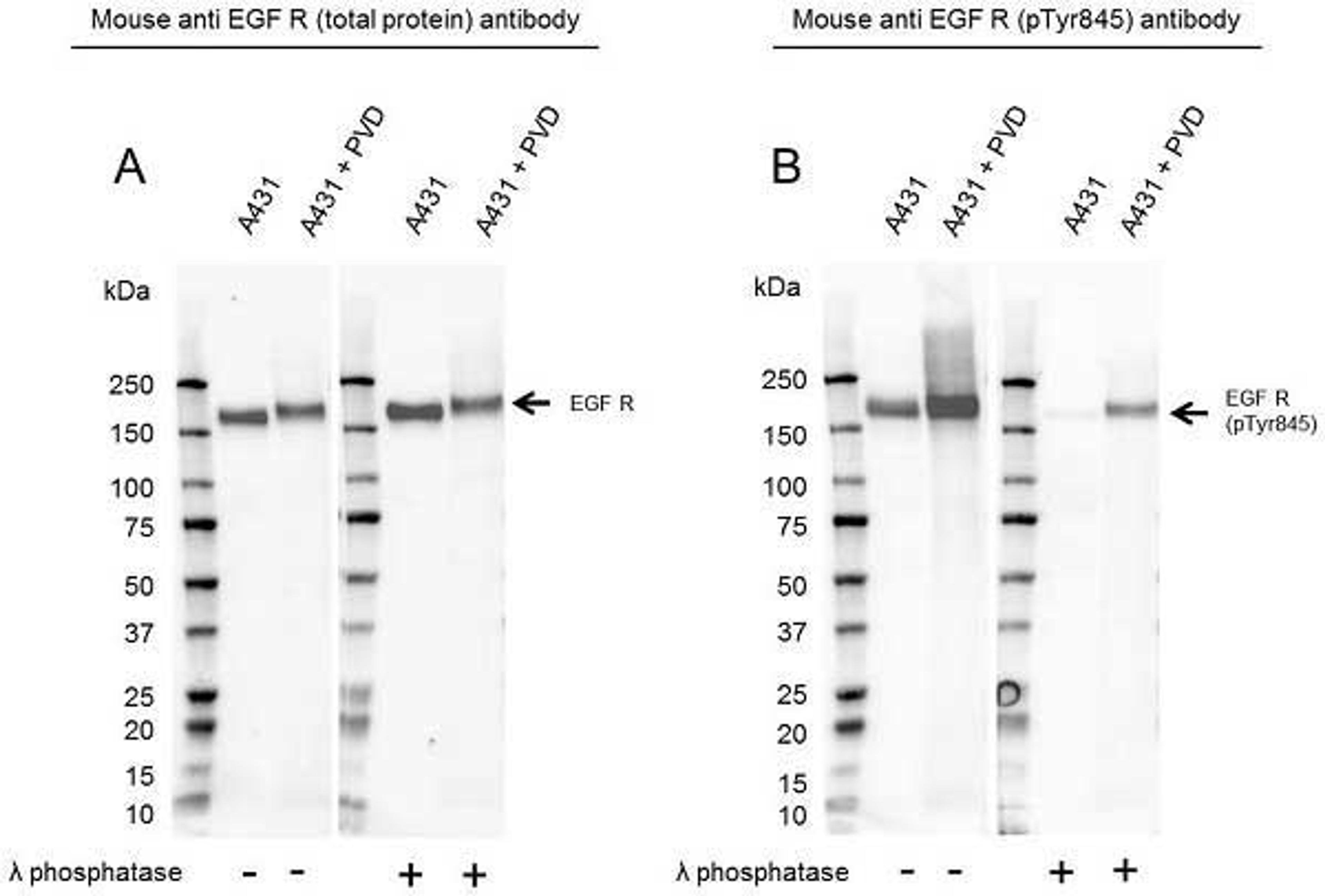 Western Blot analysis of A431 untreated and pervanadate whole cell lysates