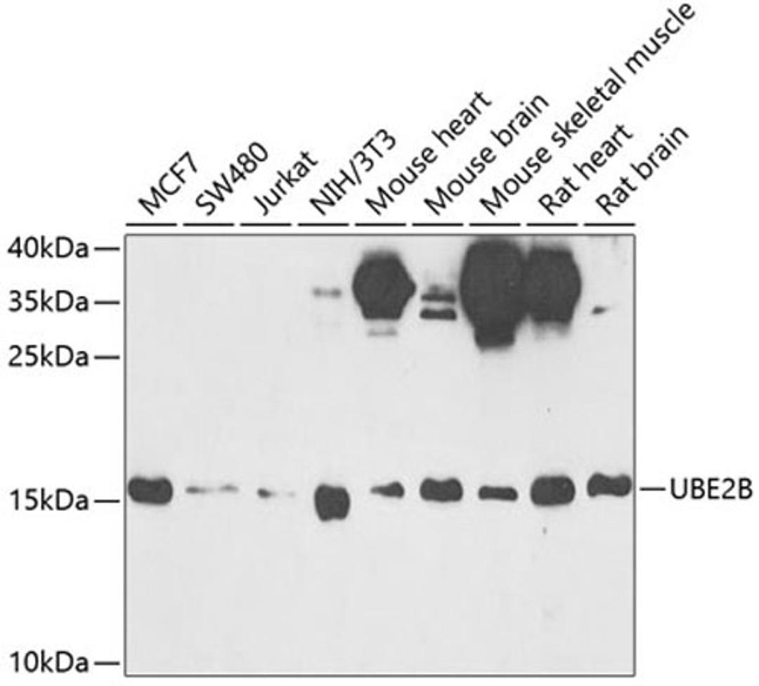 Western blot - UBE2B antibody (A6315)