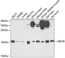 Western blot - UBE2B antibody (A6315)