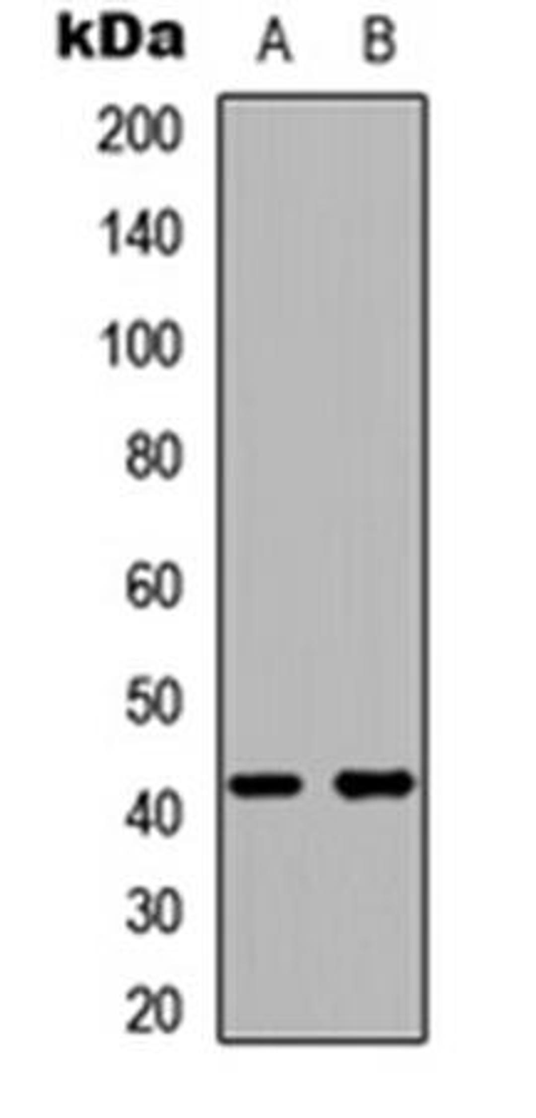 Western blot analysis of HeLa (Lane1), HepG2 (Lane2) whole cell using Kappa Opioid R antibody