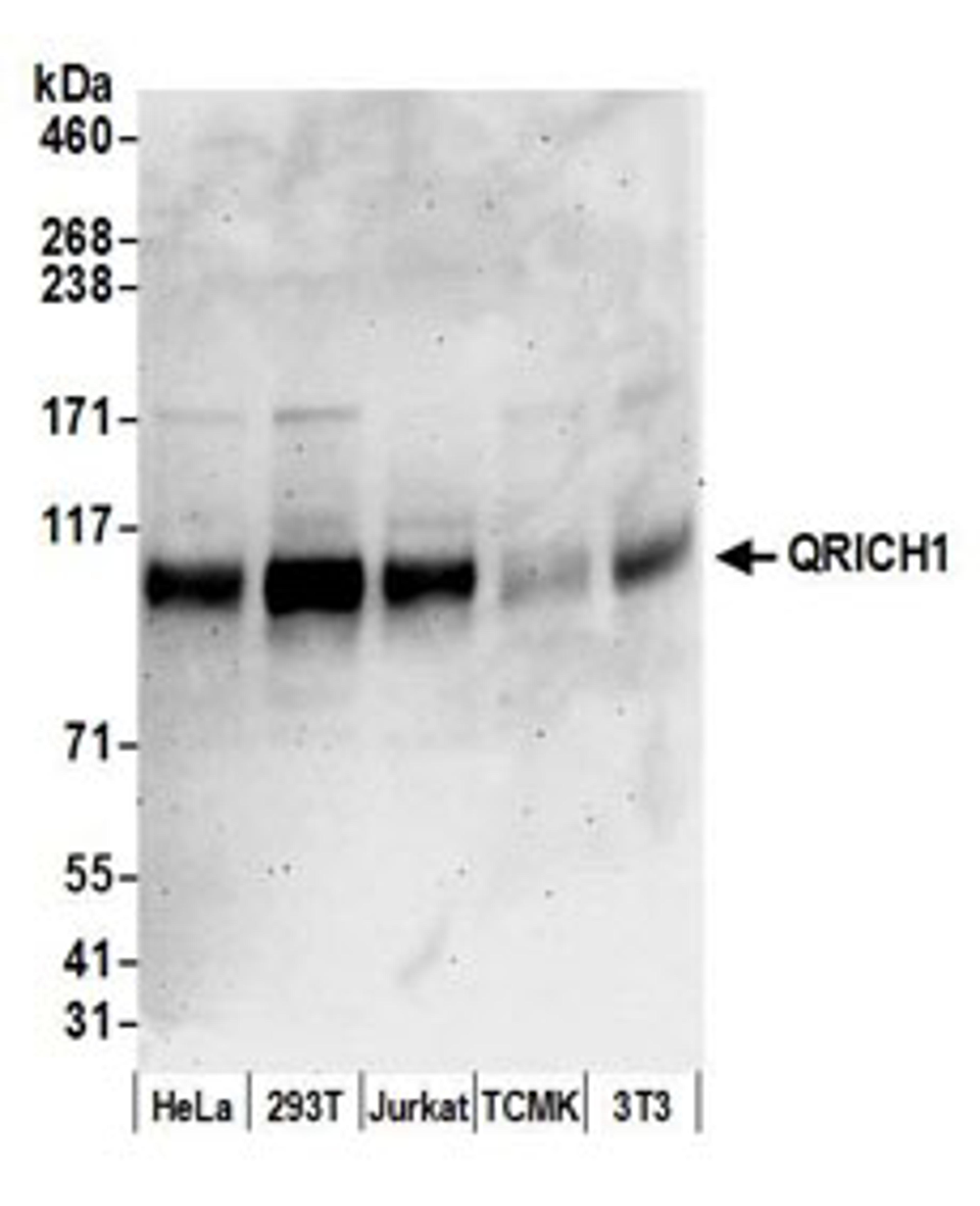 Detection of human and mouse QRICH1 by western blot.