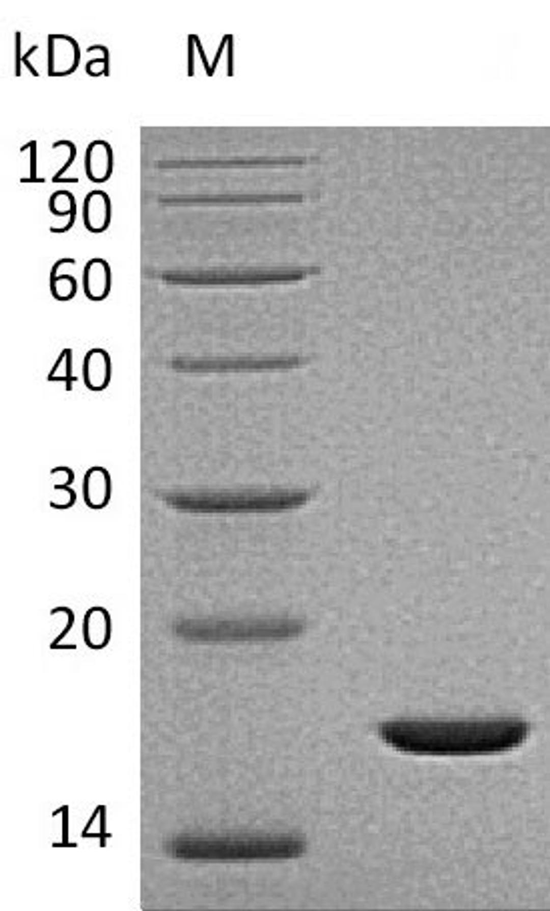 (Tris-Glycine gel) Discontinuous SDS-PAGE (reduced) with 5% enrichment gel and 15% separation gel.