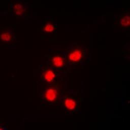 Immunofluorescense analysis of K562 cells using NF-kappaB p65 (phospho-T435) antibody