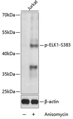 Western blot - Phospho-ELK1-S383 antibody (AP0033)