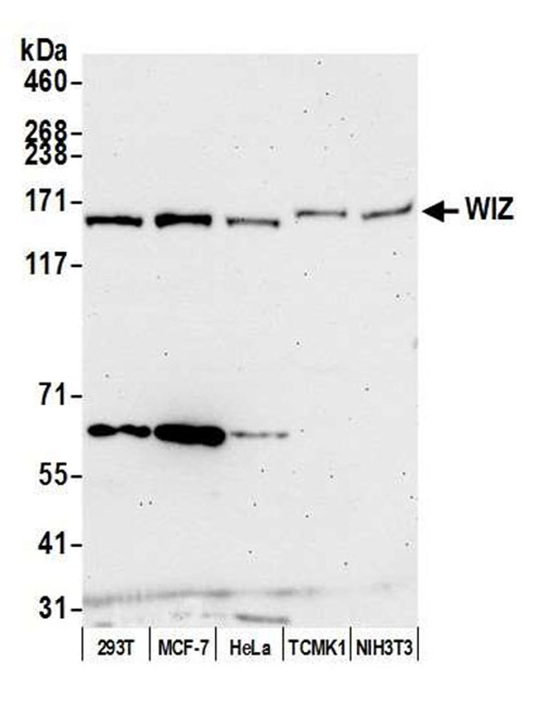 Detection of human and mouse WIZ by WB.