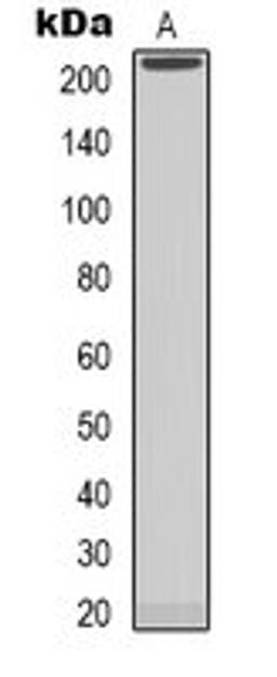 Western blot analysis of MCF7 (Lane 1) whole cell lysates using NAV1 antibody