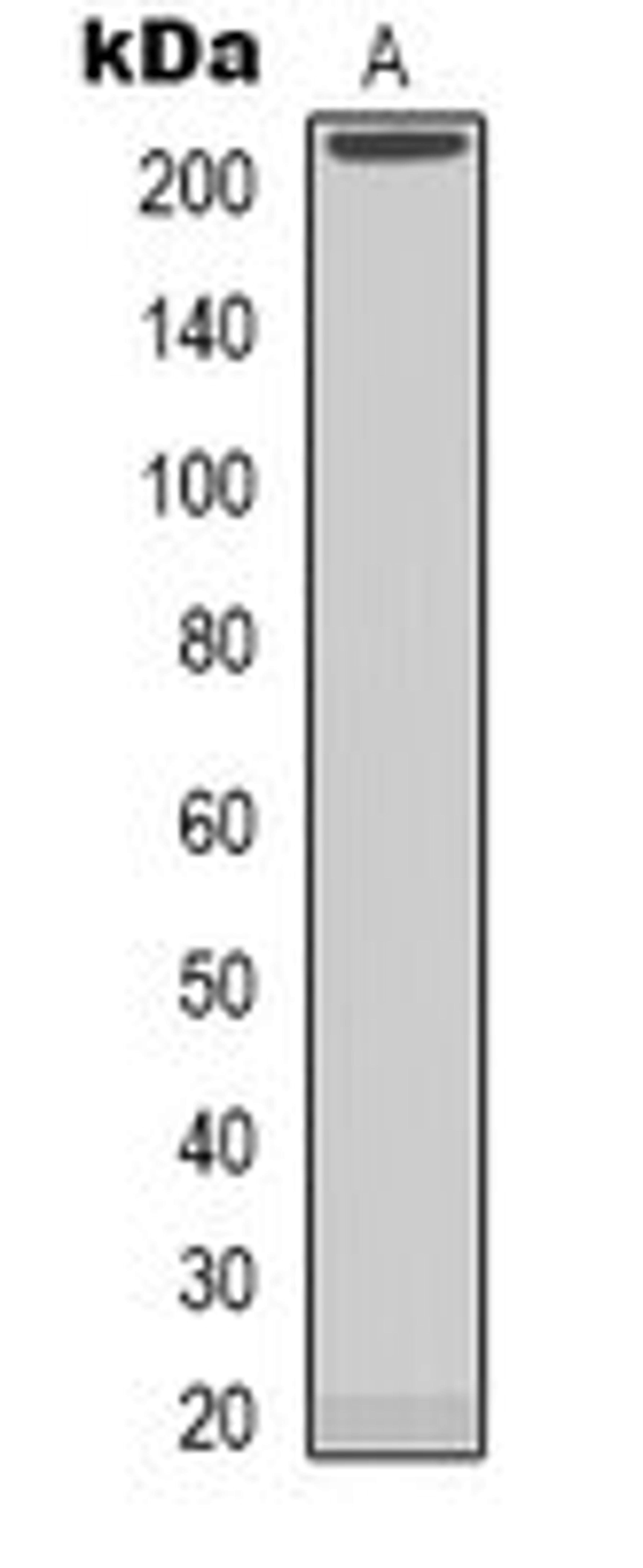 Western blot analysis of MCF7 (Lane 1) whole cell lysates using NAV1 antibody