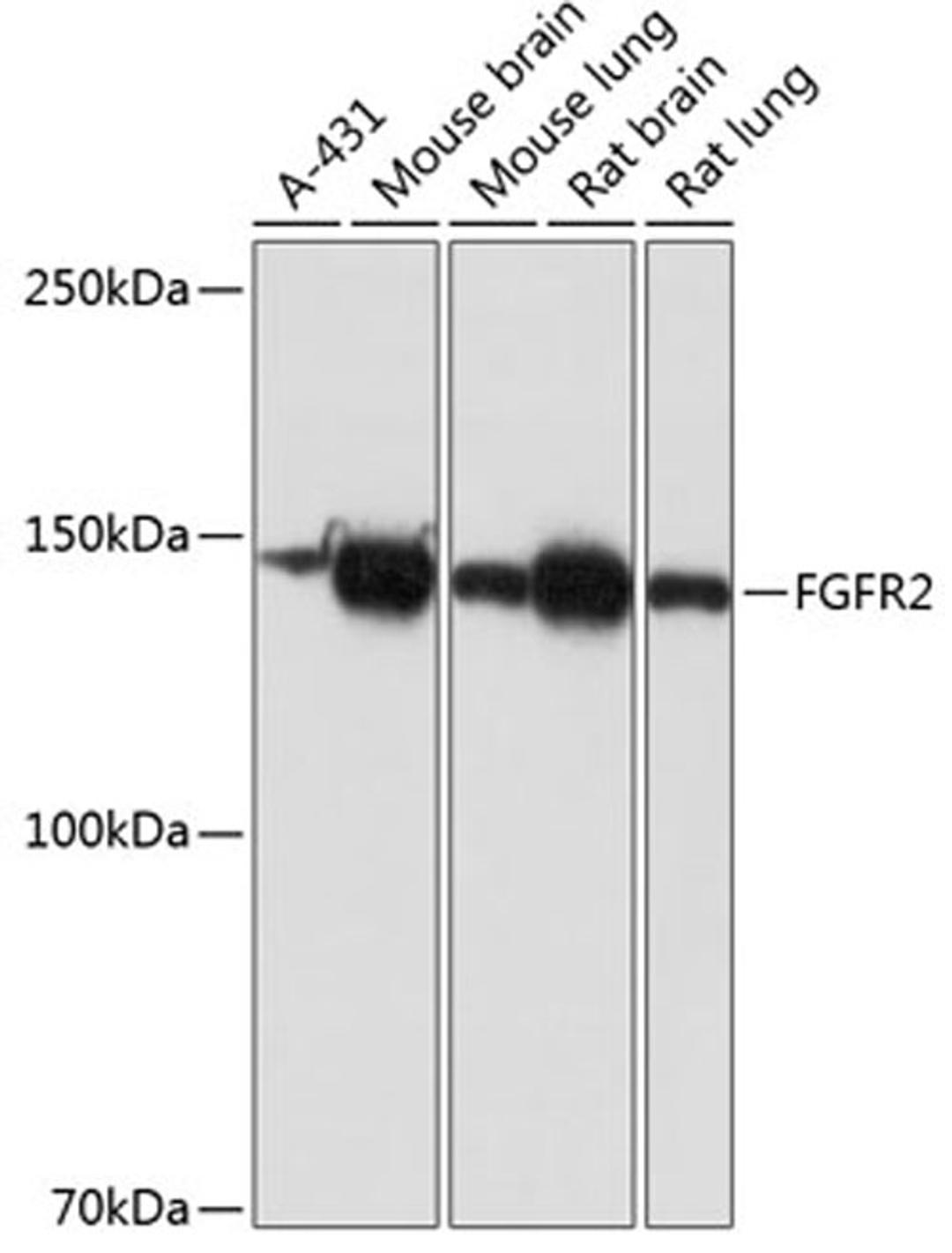 Western blot - FGFR2 antibody (A19051)