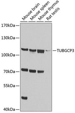 Western blot - TUBGCP3 antibody (A4417)