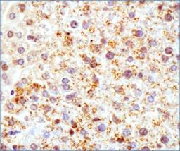 Immunohistochemistry-Paraffin: Perilipin-2/ADFP Antibody [NB110-40878] - ADFP antibody was tested in mouse liver using DAB with hematoxylin counterstain.