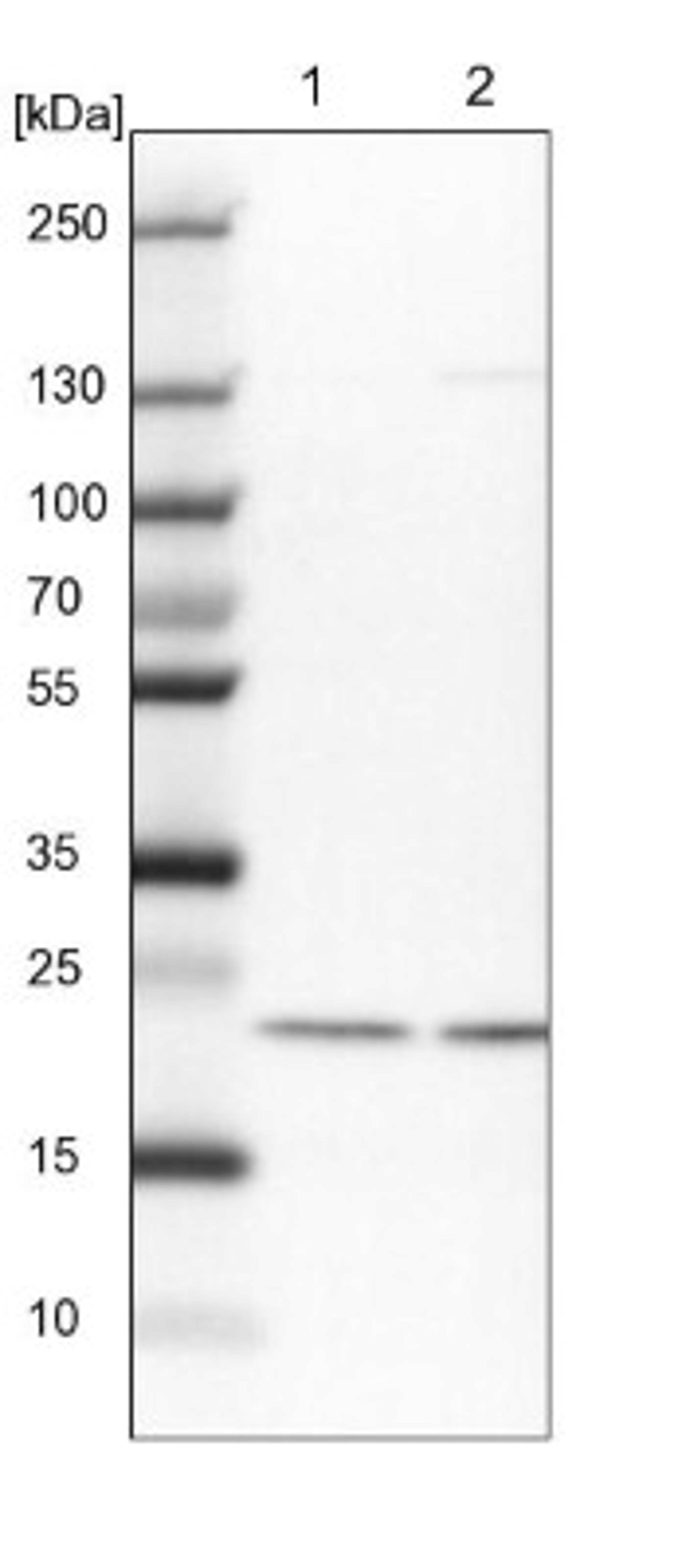 Western Blot: COMMD2 Antibody [NBP1-91802] - Lane 1: NIH-3T3 cell lysate (Mouse embryonic fibroblast cells)<br/>Lane 2: NBT-II cell lysate (Rat Wistar bladder tumour cells)