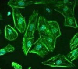 Immunocytochemistry/Immunofluorescence: ROBO1 Antibody [NB600-1254] - Staining of Robo1 in undifferentiated, immortalized human podocytes by Immunocytochemistry/ Immunofluorescence. Cells were fixed with 2% paraformaldehyde and 4% sucrose at room temperature for 10 minutes. The cells were then washed once with PBS, permeabilized with 0.3% Triton X-100 for 10 minutes and incubated with blocking solution (2% FCS, 2% BSA, 0.2% fish gelatin) for 30 minutes, before further incubation with primary Ab for 1 hour. An Alexa Fluor 488 goat anti-rabbit IgG secondary antibody was used at a dilution of 1/200. DAPI was used for nuclear counterstaining.