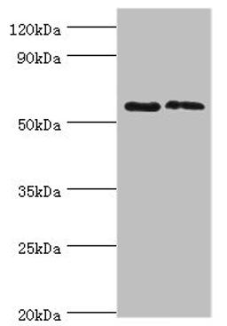 Western blot. All lanes: Alkaline phosphatase, placental type antibody at 6ug/ml. Lane 1: A549 whole cell lysate. Lane 2: Hela whole cell lysate. Secondary. Goat polyclonal to rabbit IgG at 1/10000 dilution. Predicted band size: 58 kDa. Observed band size: 58 kDa.