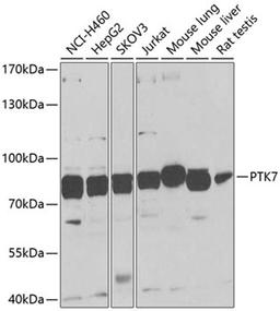 Western blot - PTK7 antibody (A9839)