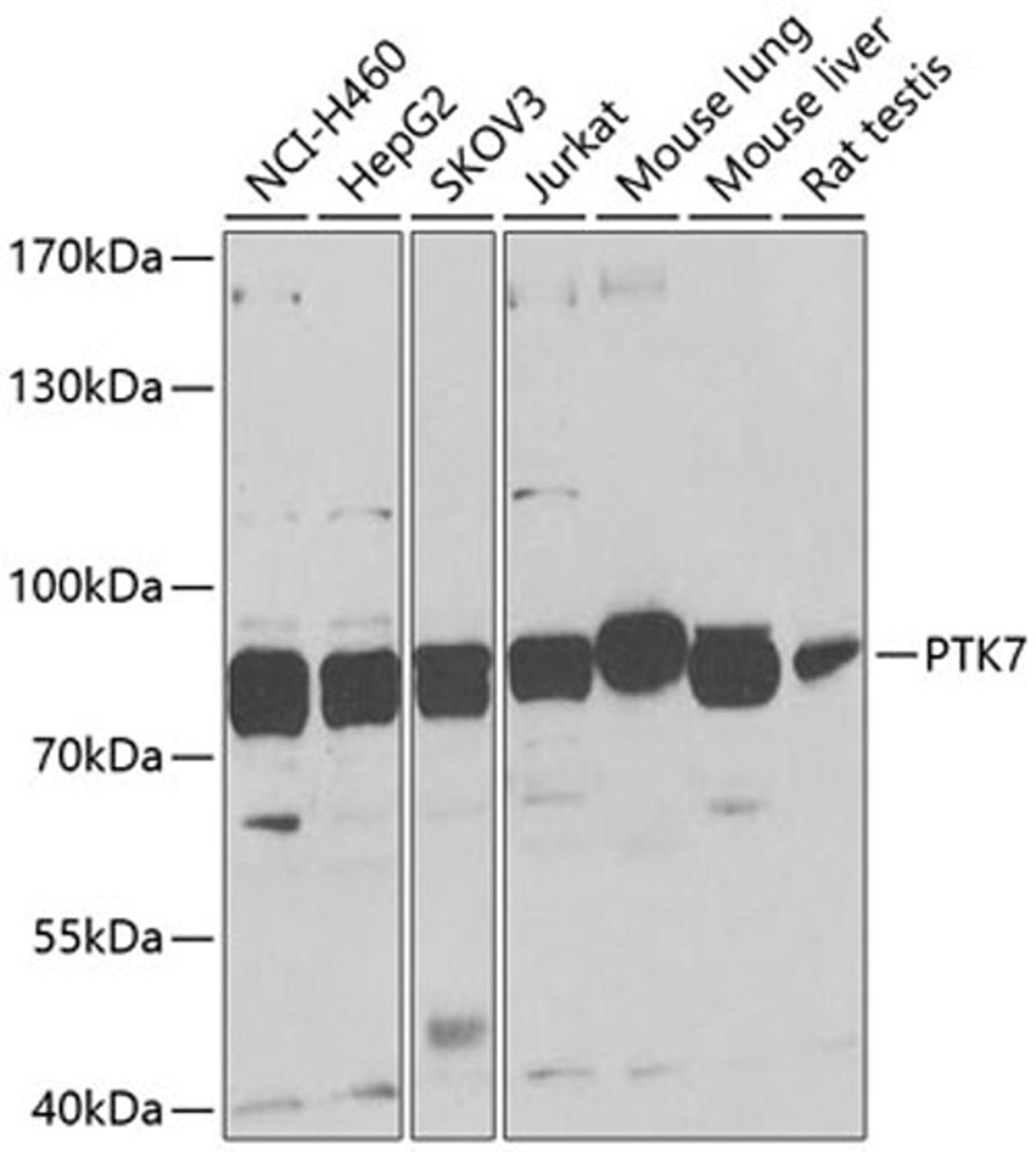 Western blot - PTK7 antibody (A9839)