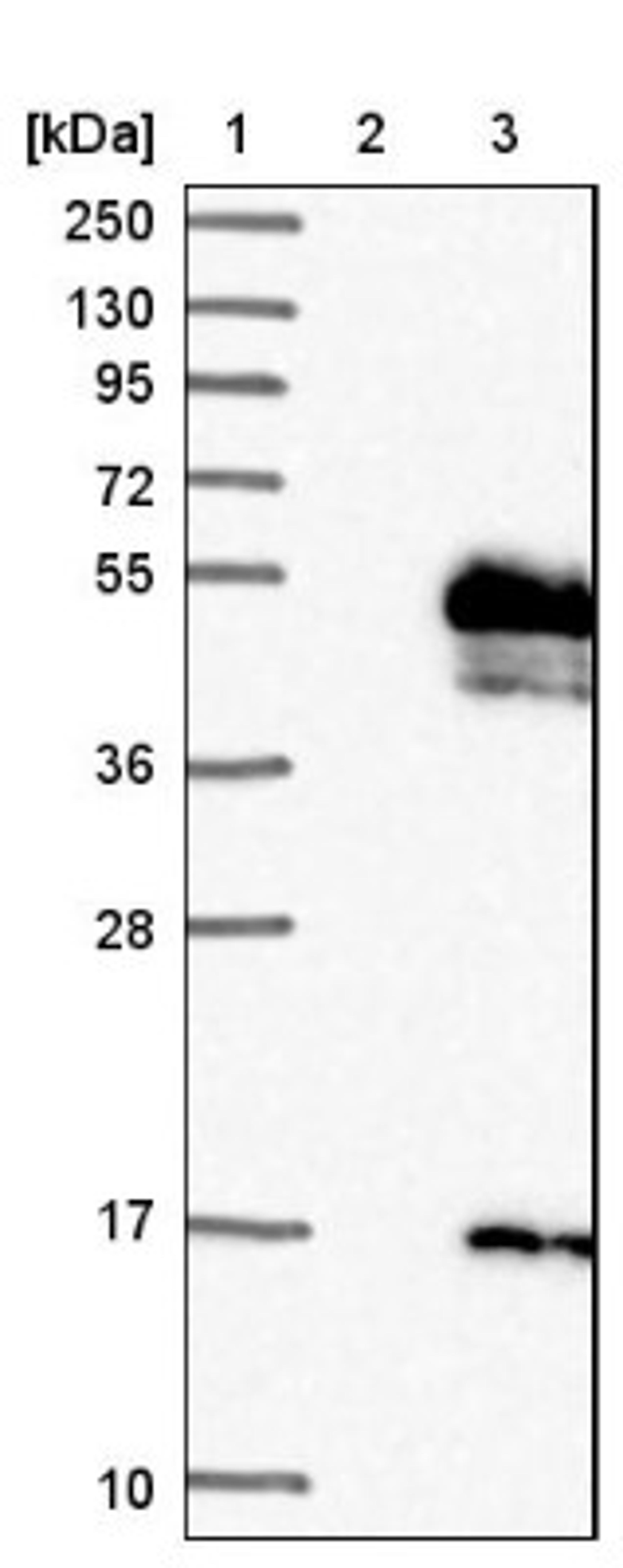 Western Blot: CRELD1 Antibody [NBP1-88917] - Lane 1: Marker [kDa] 250, 130, 95, 72, 55, 36, 28, 17, 10<br/>Lane 2: Negative control (vector only transfected HEK293T lysate)<br/>Lane 3: Over-expression lysate (Co-expressed with a C-terminal myc-DDK tag (~3.1 kDa) in mammalian HEK293T cells, LY422168)