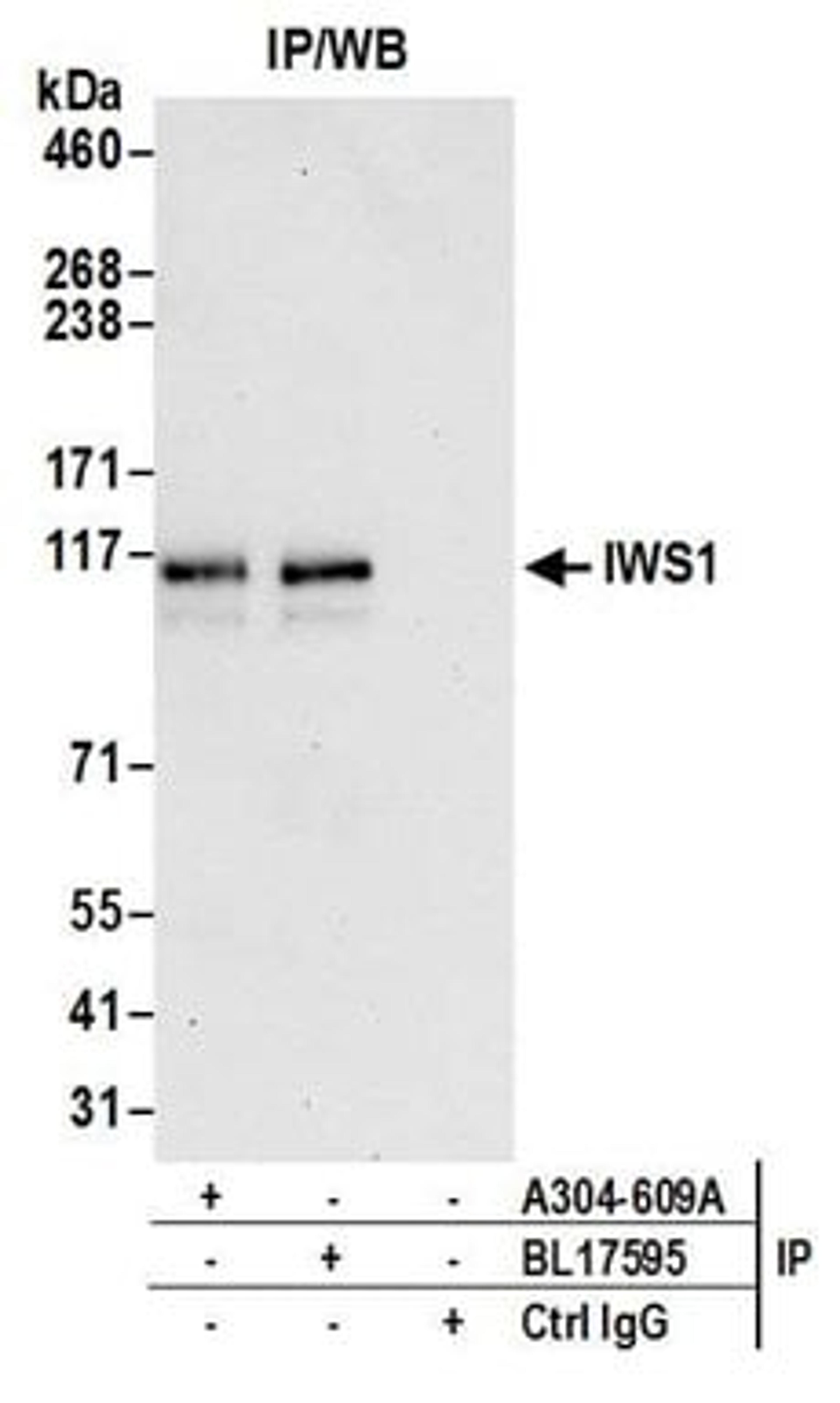 Detection of human IWS1 by western blot of immunoprecipitates.