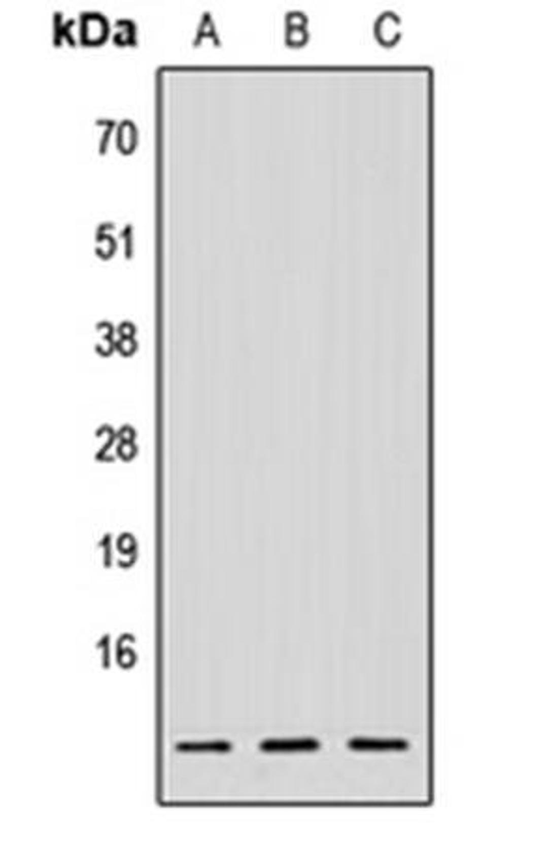 Western blot analysis of HeLa (Lane1), Raw264.7 (Lane2), PC12 (Lane3) whole cell using NDUFV3 antibody