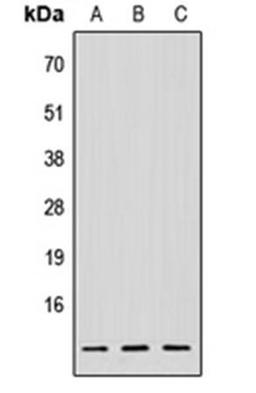 Western blot analysis of HeLa (Lane1), Raw264.7 (Lane2), PC12 (Lane3) whole cell using NDUFV3 antibody