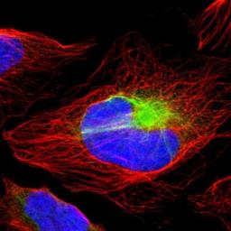 Immunocytochemistry/Immunofluorescence: RBM23 Antibody [NBP1-83857] - Staining of human cell line U-2 OS shows positivity in cytoskeleton (intermediate filaments).