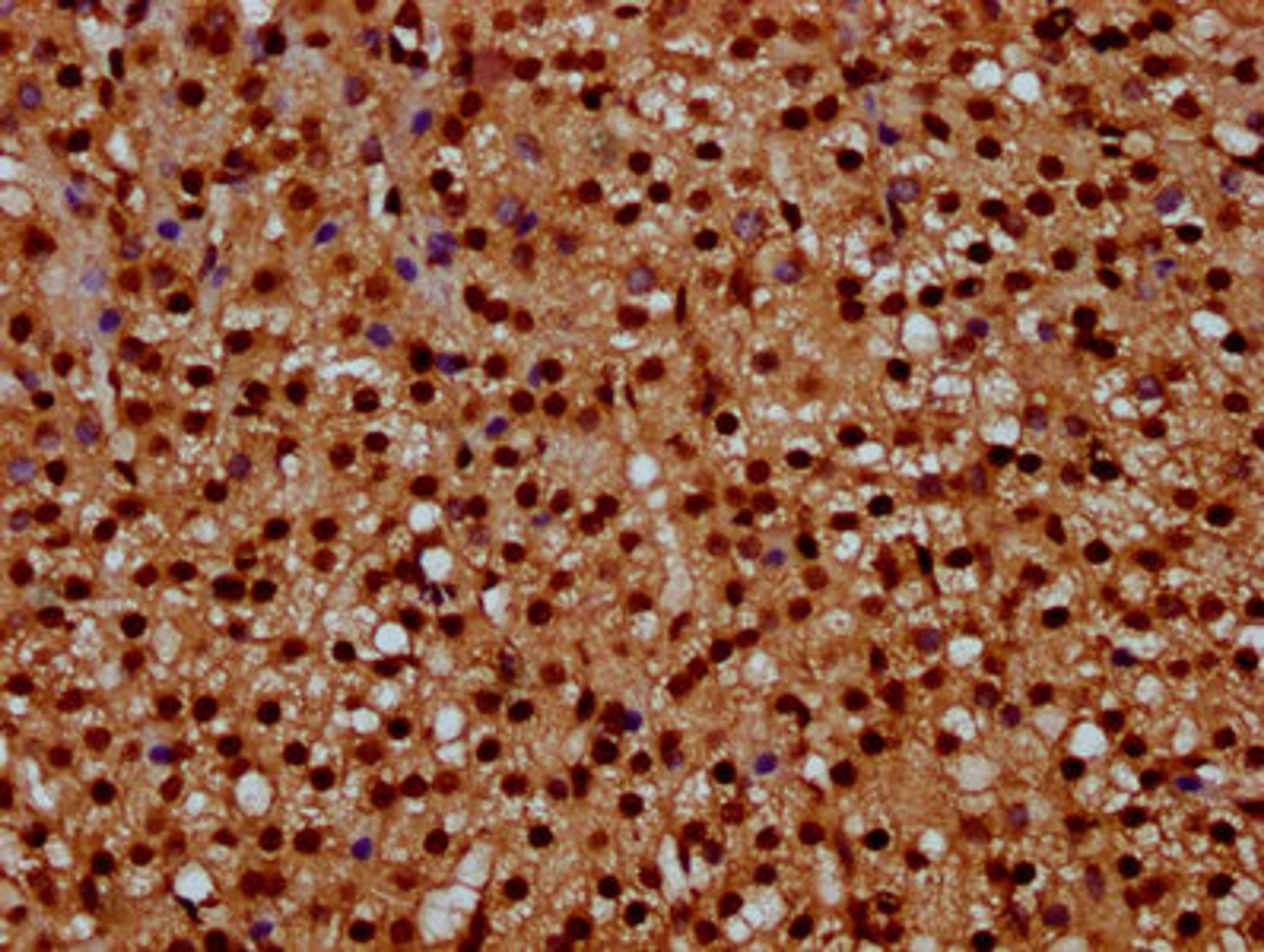 IHC image of CSB-PA010429OA08npropHU diluted at 1:10 and staining in paraffin-embedded human adrenal gland tissue performed on a Leica BondTM system. After dewaxing and hydration, antigen retrieval was mediated by high pressure in a citrate buffer (pH 6.0). Section was blocked with 10% normal goat serum 30min at RT. Then primary antibody (1% BSA) was incubated at 4°C overnight. The primary is detected by a biotinylated secondary antibody and visualized using an HRP conjugated SP system.