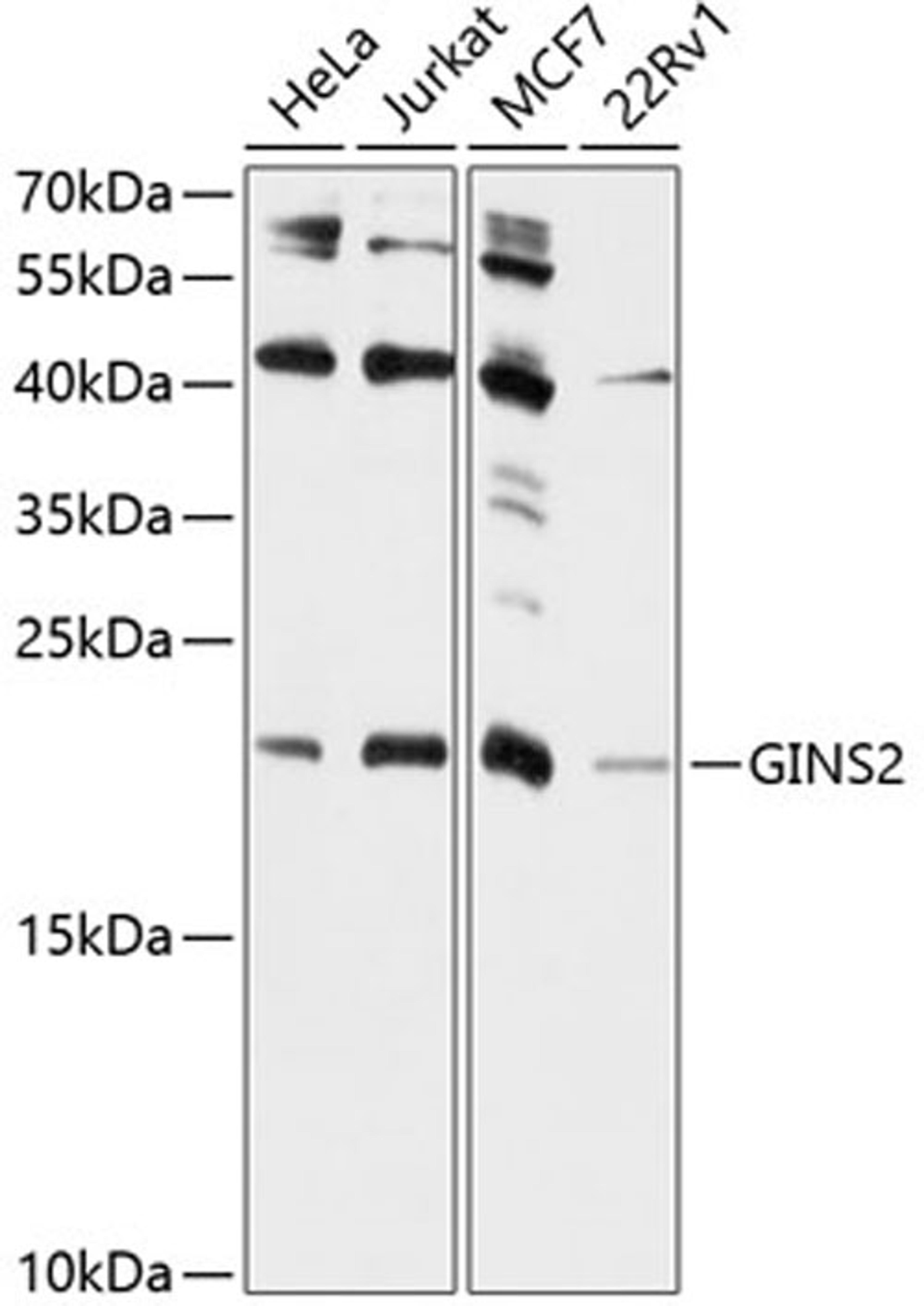 Western blot - GINS2 antibody (A9172)