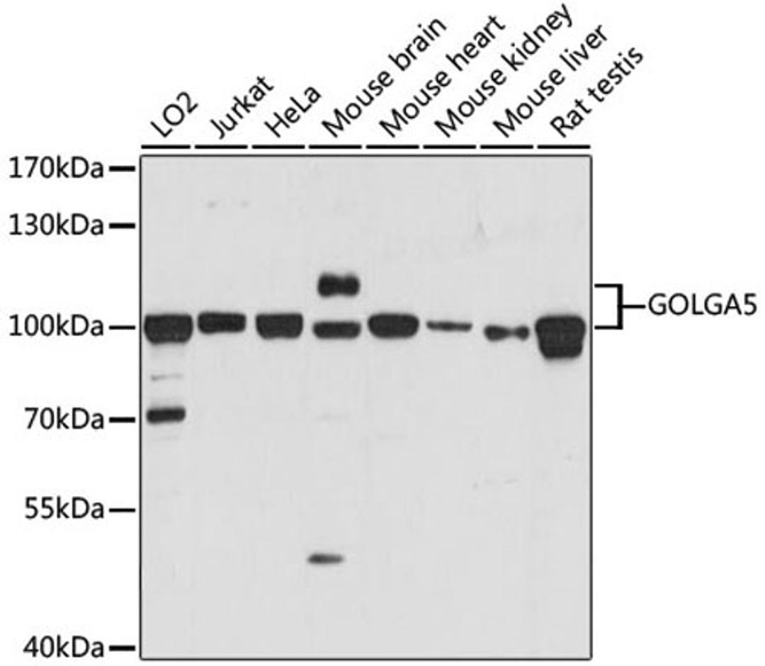 Western blot - GOLGA5 antibody (A15768)