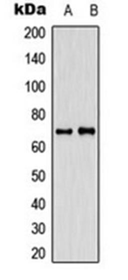 Western blot analysis of SHSY5Y (Lane 1), HeLa (Lane 2) whole cell lysates using CABLES1 antibody