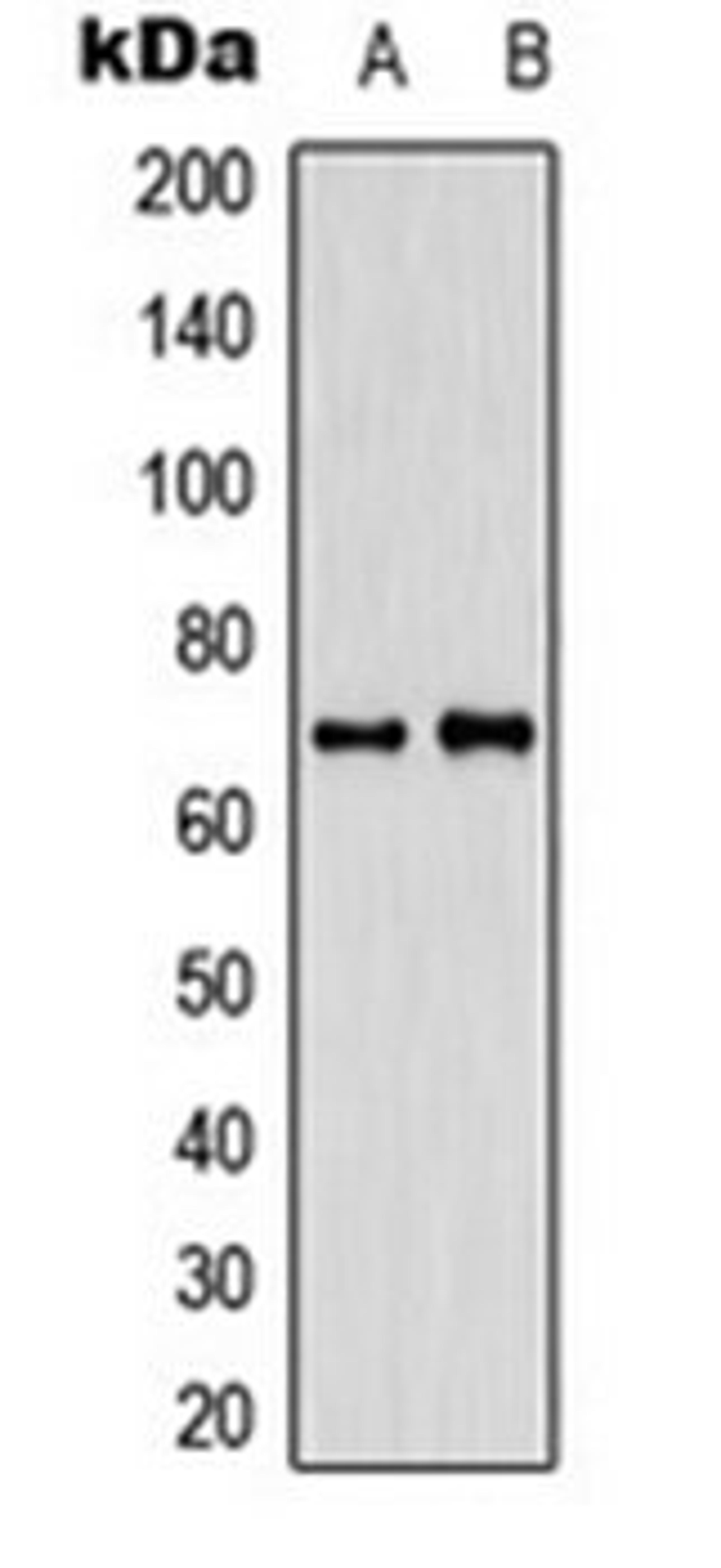 Western blot analysis of SHSY5Y (Lane 1), HeLa (Lane 2) whole cell lysates using CABLES1 antibody