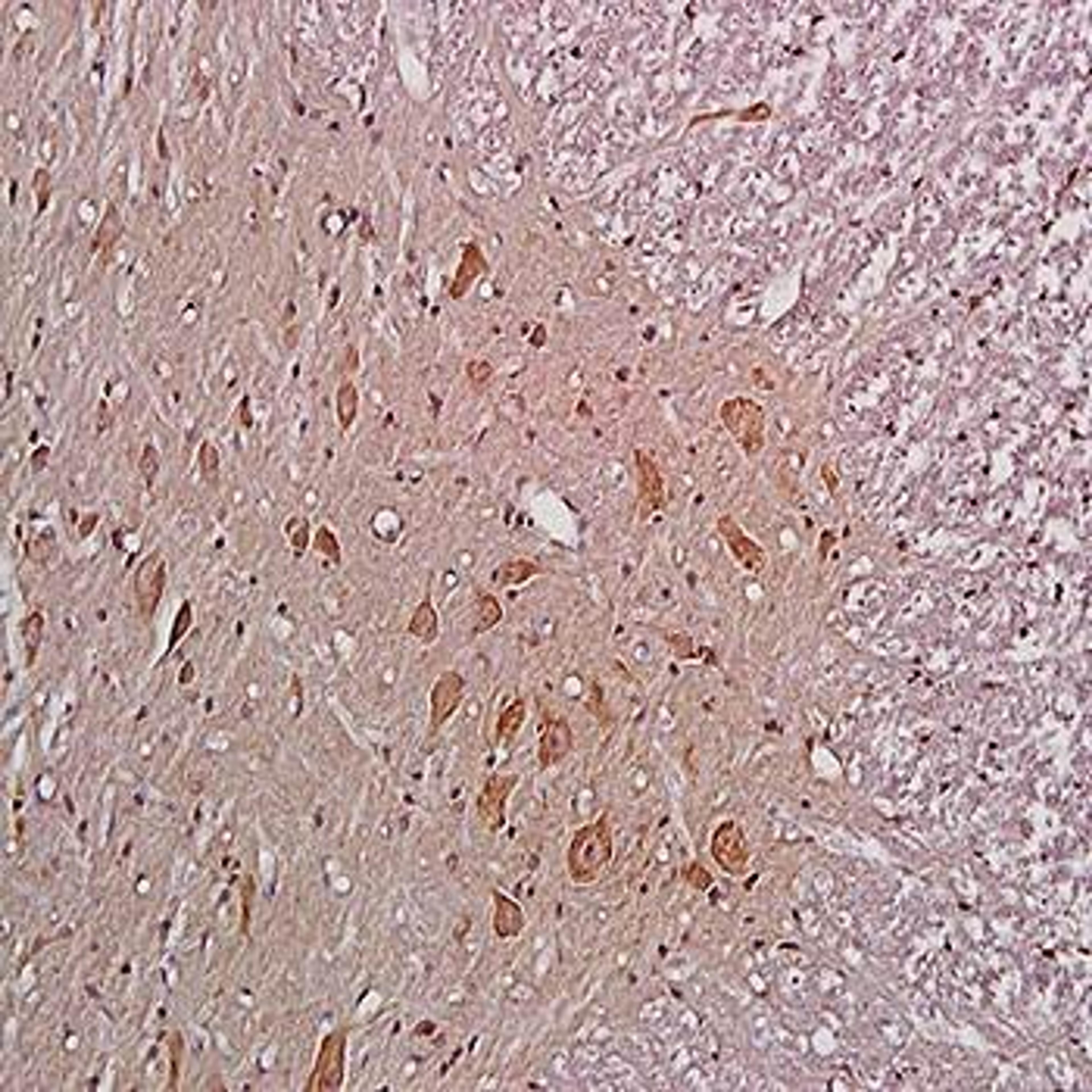 Immunohistochemical analysis of formalin-fixed and paraffin embedded rat spinal cord tissue (Dilution at:1:200) using NMDAR1 antibody