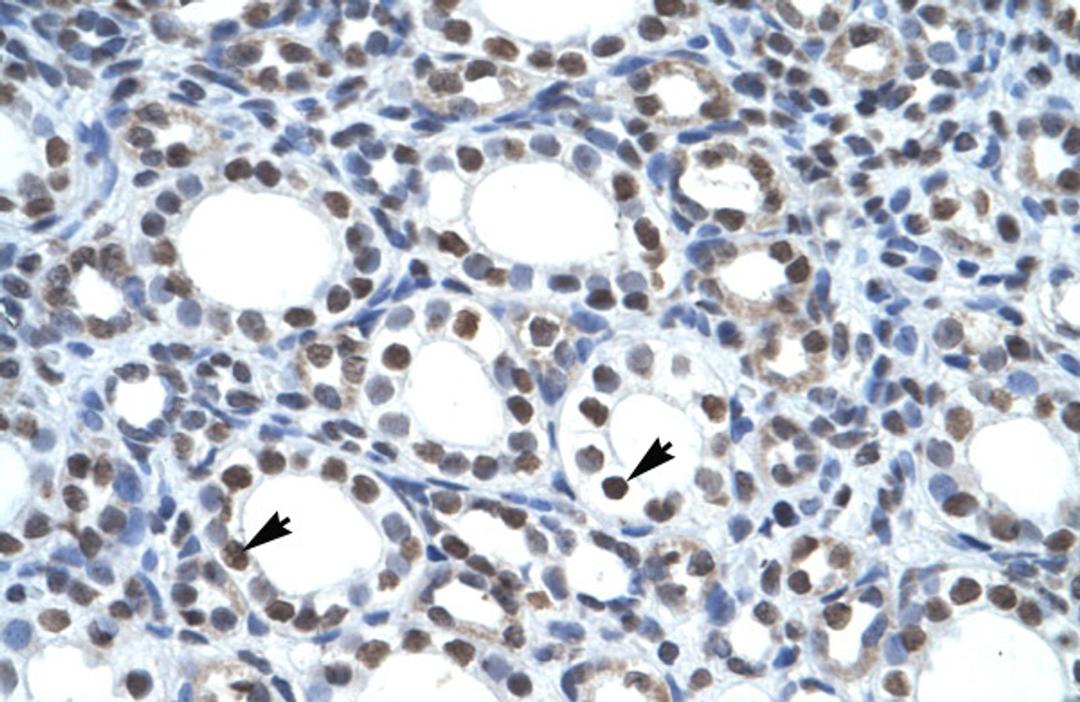 Antibody used in IHC on Human kidney.