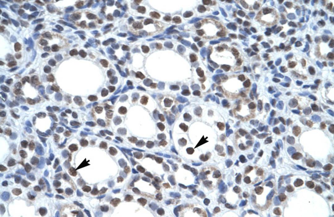 Antibody used in IHC on Human kidney.