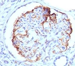 Formalin-fixed, paraffin-embedded human kidney stained with WT1 antibody (WT1/857).